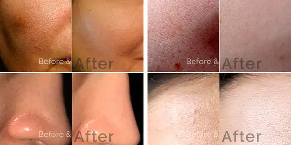 SKIN BRIGHTENING SERUM