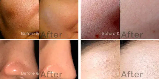 SKIN BRIGHTENING SERUM